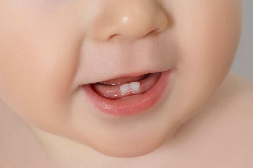 Timing is Everything: Understanding When Baby Teeth Come In - Baby Bubble